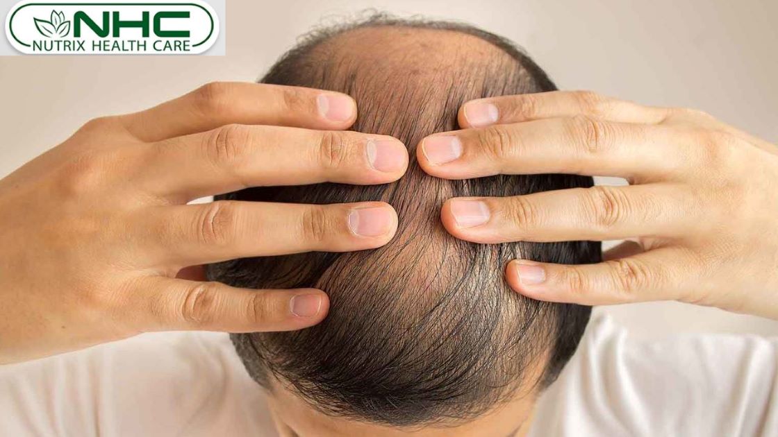 sudden hair fall reasons in male